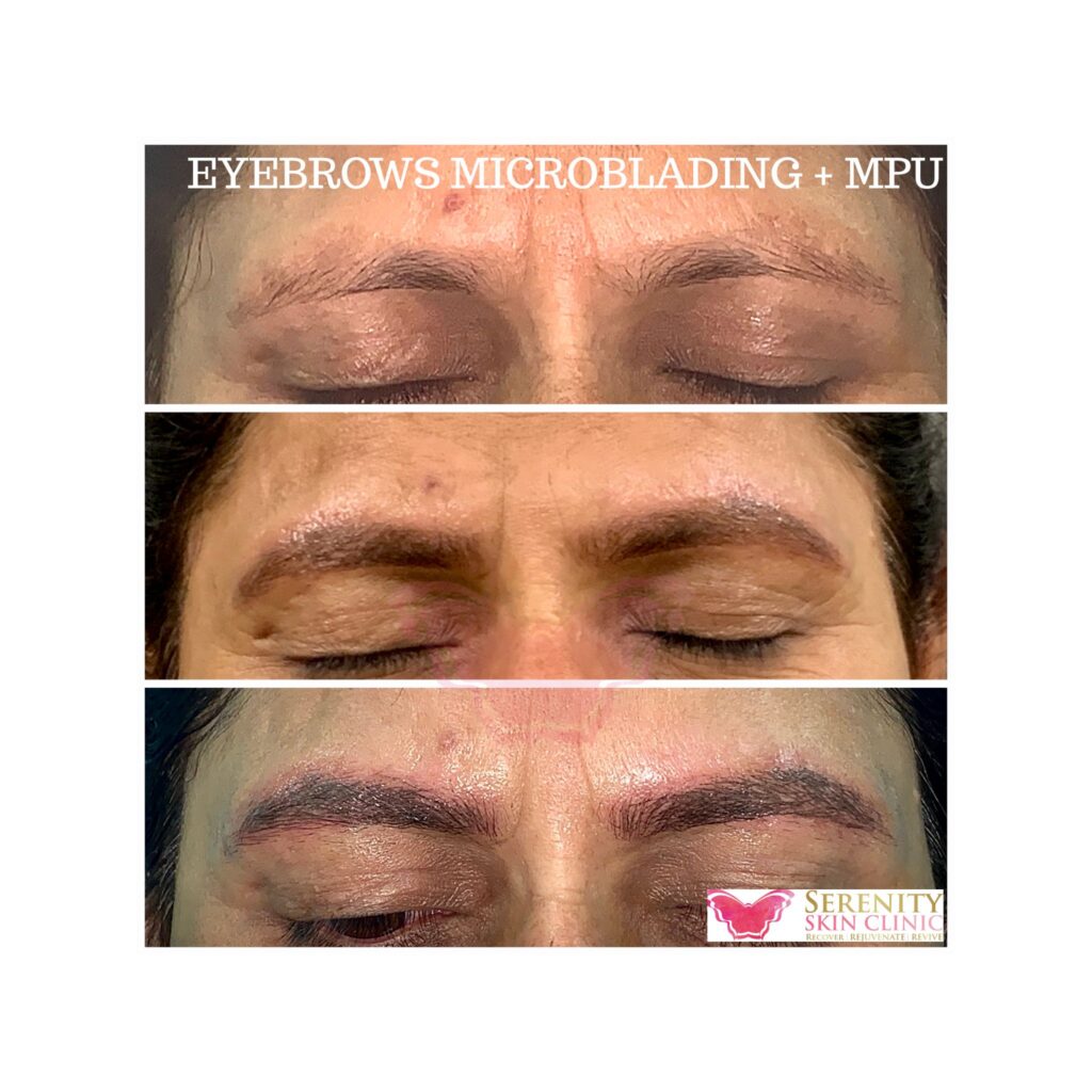eyebrow microblading